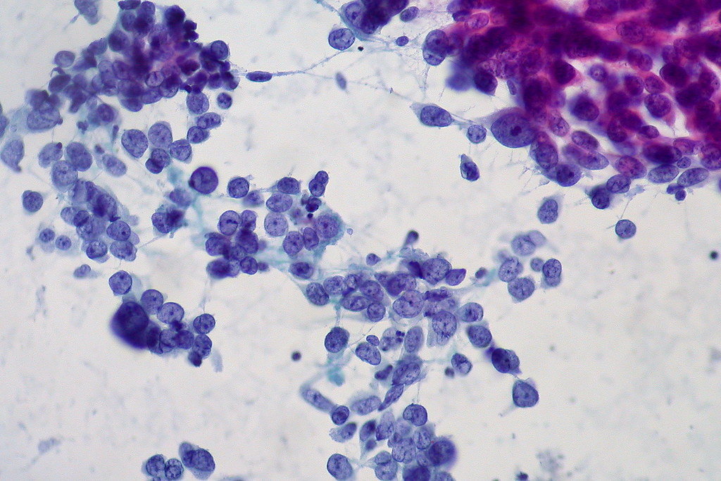 B csoportú Streptococcus vizsgálata (hüvelyváladékból várandósság alat - SYNLAB
